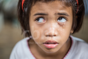 Magil had cataracts in both eyes leaving her blind.